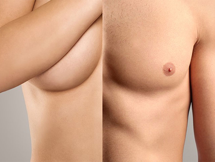 antes e depois mastectomia